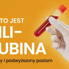 Co to jest bilirubina? Wyjaśnienie norm i sytuacji, gdy występuje podwyższona bilirubina. Ręka w rękawiczce trzyma probówkę z krwią.