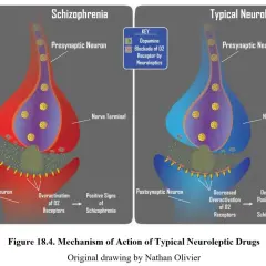 Schemat działania neuroleptyków: schizofrenia (nadaktywne receptory D2) vs. typowe neuroleptyki (blokada receptorów D2).