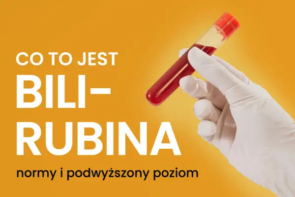 Co to jest bilirubina? Wyjaśnienie norm i sytuacji, gdy występuje podwyższona bilirubina. Ręka w rękawiczce trzyma probówkę z krwią.